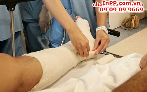 [Sơ cấp cứu] – Cách sơ cứu gãy xương, 589, Minh Thiện, InPP.com.vn, 13/08/2015 22:38:54